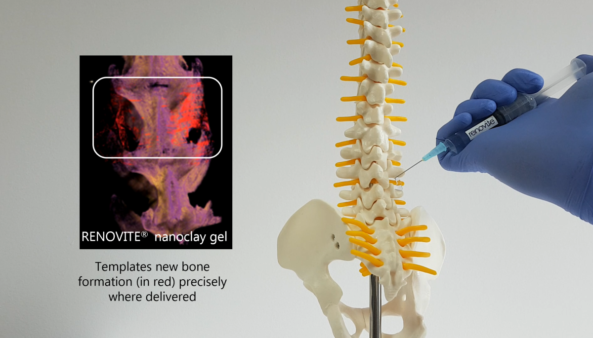 Scale-Up Member Renovos wins funding to develop innovative technology to aid bone healing