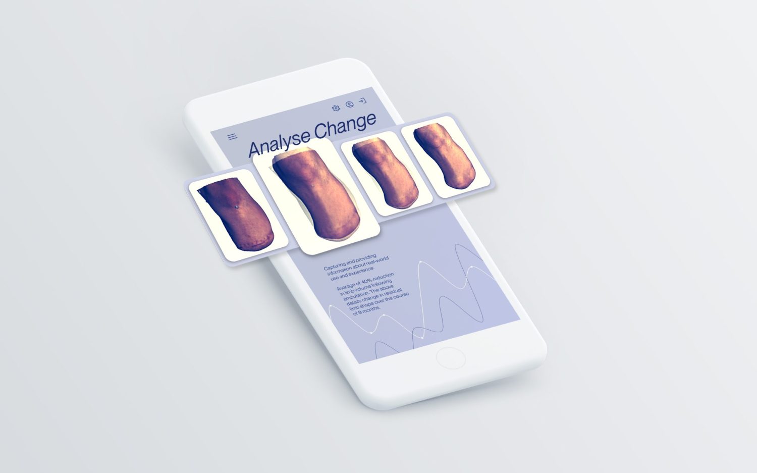 Radii Devices wins funding to improve veterans’ healthcare